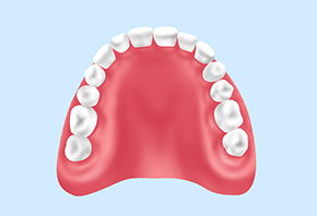 レジン床義歯（保険入れ歯）